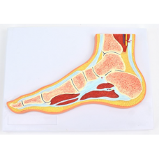 Human Foot Joint Muscle MRI Section