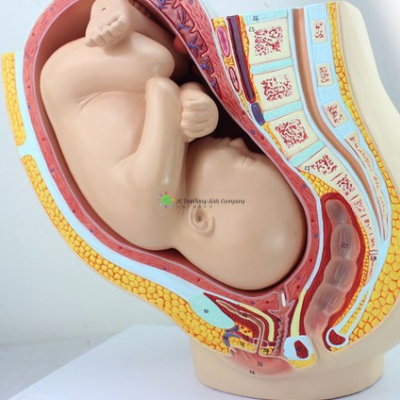 Pregnancy Pelvis with Mature Fetus, 2-parts