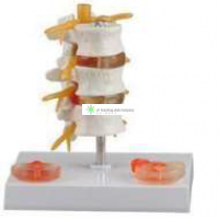 3 Lumbar Vertebrae