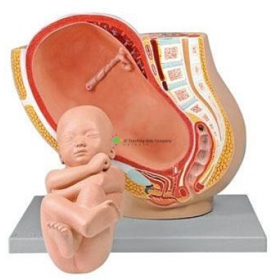 Pregnancy Pelvis with Mature Fetus, 2-parts