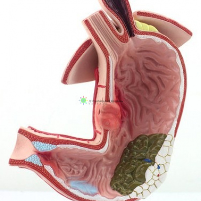 Gastric Diseases